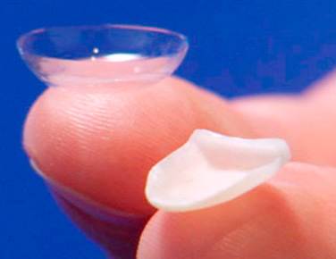 Lentes de contato dental são uma alternativa para fechar espaços pequenos e alterar a cor dos dentes